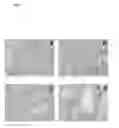 Fig. 06 - METHOD OF DIAGNOSING RENAL DISORDERS