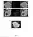 Fig. 02 - Hemoglobin-based oxygen carrier-containing pharmaceutical composition for cancer targeting treatment and prevention of cancer recurrence