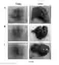 Fig. 19 - Hemoglobin-based oxygen carrier-containing pharmaceutical composition for cancer targeting treatment and prevention of cancer recurrence
