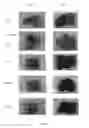Fig. 22 - Hemoglobin-based oxygen carrier-containing pharmaceutical composition for cancer targeting treatment and prevention of cancer recurrence