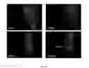 Fig. 25 - Hemoglobin-based oxygen carrier-containing pharmaceutical composition for cancer targeting treatment and prevention of cancer recurrence