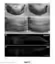Fig. 04 - COMPOSITIONS AND METHODS FOR INDUCING DISRUPTION OF BLOOD VASCULATURE AND FOR REDUCING ANGIOGENESIS