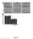 Fig. 20 - COMPOSITIONS AND METHODS FOR INDUCING DISRUPTION OF BLOOD VASCULATURE AND FOR REDUCING ANGIOGENESIS