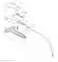 Fig. 01 - Self-anchoring sling and introducer system