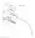 Fig. 06 - Self-anchoring sling and introducer system