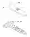 Fig. 02 - Self-anchoring sling and introducer system