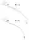 Fig. 07 - Self-anchoring sling and introducer system