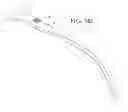 Fig. 08 - Self-anchoring sling and introducer system