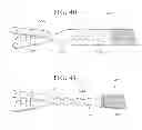 Fig. 35 - Self-anchoring sling and introducer system