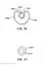 Fig. 14 - Illuminated suction apparatus