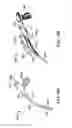 Fig. 15 - Illuminated suction apparatus
