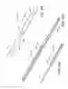 Fig. 35 - Methods for detection of cardiac rhythm disorders using basket style cardiac mapping catheter