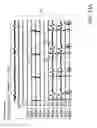 Fig. 44 - Methods for detection of cardiac rhythm disorders using basket style cardiac mapping catheter