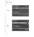 Fig. 46 - Conductive polymer fibers, method and device for producing conductive polymer fibers, biological electrode, device for measuring biological signals, implantable electrode, and device for measuring biological signals
