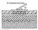 Fig. 01 - Non-invasive segmentable three-dimensional microelectrode array patch for neurophysiological diagnostics and therapeutic stimulation