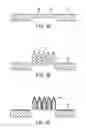 Fig. 03 - Non-invasive segmentable three-dimensional microelectrode array patch for neurophysiological diagnostics and therapeutic stimulation