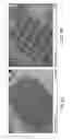 Fig. 04 - Non-invasive segmentable three-dimensional microelectrode array patch for neurophysiological diagnostics and therapeutic stimulation