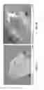 Fig. 05 - Non-invasive segmentable three-dimensional microelectrode array patch for neurophysiological diagnostics and therapeutic stimulation