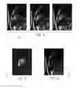 Fig. 05 - MRI WITH STATIC TISSUE REMOVAL