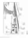 Fig. 10 - BREAST BIOPSY SYSTEM USING MR AND GAMMA IMAGING