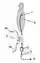 Fig. 01 - RF-safe interventional or non-interventional instrument for use in an MRI apparatus