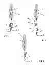 Fig. 02 - RF-safe interventional or non-interventional instrument for use in an MRI apparatus