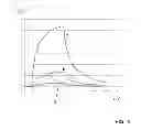 Fig. 03 - RF-safe interventional or non-interventional instrument for use in an MRI apparatus