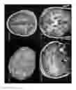 Fig. 07 - Surgical Navigation Planning System and Associated Methods