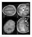 Fig. 08 - Surgical Navigation Planning System and Associated Methods