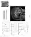 Fig. 02 - Magnetic Resonance Based Method for Assessing Alzheimer's Disease and Related Pathologies