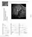 Fig. 03 - Magnetic Resonance Based Method for Assessing Alzheimer's Disease and Related Pathologies