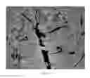 Fig. 07 - Magnetic Resonance Based Method for Assessing Alzheimer's Disease and Related Pathologies
