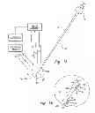 Fig. 02 - Apparatus and methods for using an electromagnetic transponder in orthopedic procedures