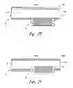 Fig. 04 - Apparatus and methods for using an electromagnetic transponder in orthopedic procedures