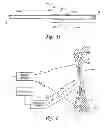 Fig. 06 - Apparatus and methods for using an electromagnetic transponder in orthopedic procedures