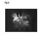 Fig. 03 - Fluorescent light phantom device and fluorescent light imaging method