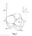 Fig. 06 - VISUALISATION CATHETER