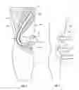 Fig. 06 - Functional knit orthopedic device