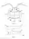 Fig. 02 - Posture correction girdle and the method of correcting spinal deformity