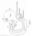 Fig. 06 - Intestinal sleeve