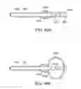 Fig. 43 - Intestinal sleeve