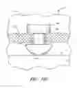 Fig. 40 - IMPLANTS WITH CONTROLLED DRUG DELIVERY FEATURES AND METHODS OF USING SAME