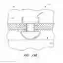 Fig. 41 - IMPLANTS WITH CONTROLLED DRUG DELIVERY FEATURES AND METHODS OF USING SAME