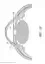 Fig. 60 - IMPLANTS WITH CONTROLLED DRUG DELIVERY FEATURES AND METHODS OF USING SAME