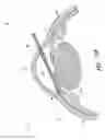Fig. 63 - IMPLANTS WITH CONTROLLED DRUG DELIVERY FEATURES AND METHODS OF USING SAME