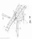 Fig. 69 - IMPLANTS WITH CONTROLLED DRUG DELIVERY FEATURES AND METHODS OF USING SAME