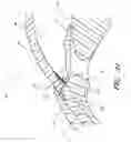 Fig. 71 - IMPLANTS WITH CONTROLLED DRUG DELIVERY FEATURES AND METHODS OF USING SAME