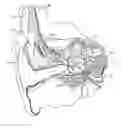 Fig. 01 - Atraumatic modiolar hugging electrode