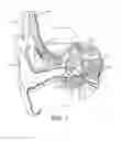 Fig. 02 - Atraumatic modiolar hugging electrode