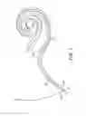 Fig. 08 - Atraumatic modiolar hugging electrode